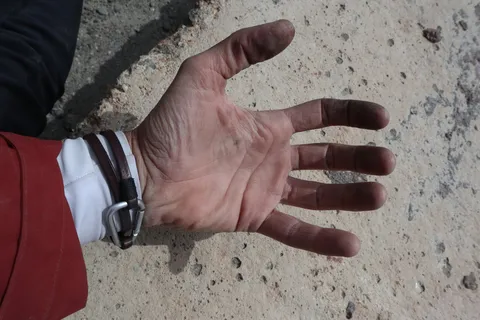 Dryness and cold are taking a toll on my hands