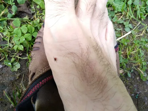 Not even 2 hours into the "Post-Corona" part of my trip and I already spot the first tick on my foot while taking a rest on a bench :(