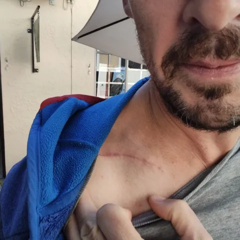 Clavicle looking gooooood!